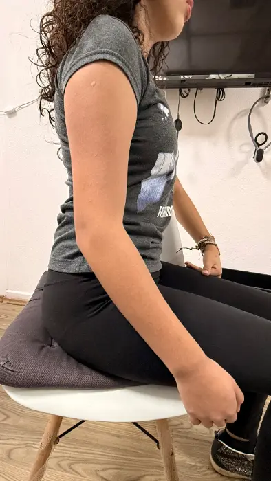 Evaluación postural y de extremidad superior a paciente adolescente en RehabiliTO