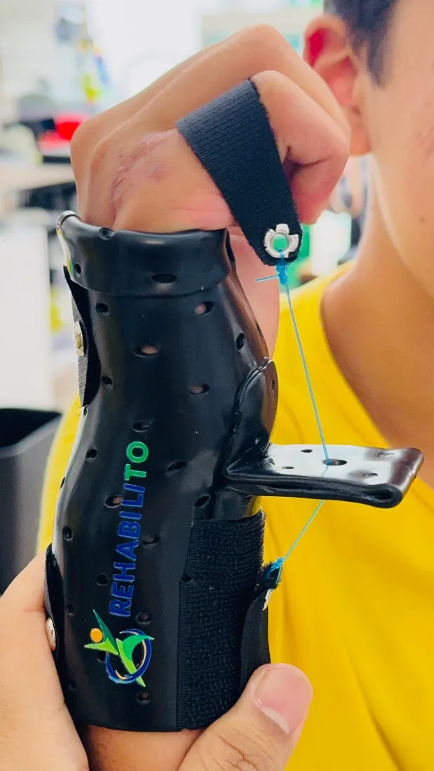 Órtesis de muñeca termoplástica negra con logo RehabiliTO y sistema dinámico
