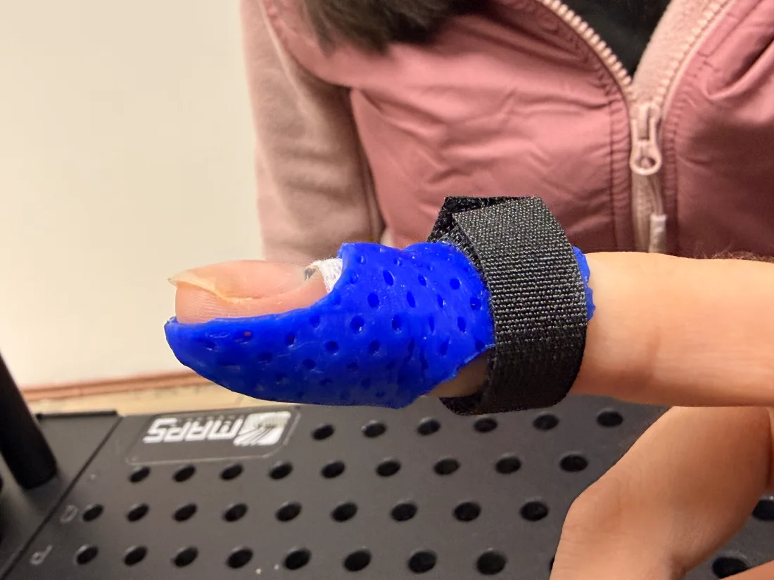 Órtesis termoplástica azul perforada para pulgar con velcro fabricada en RehabiliTO