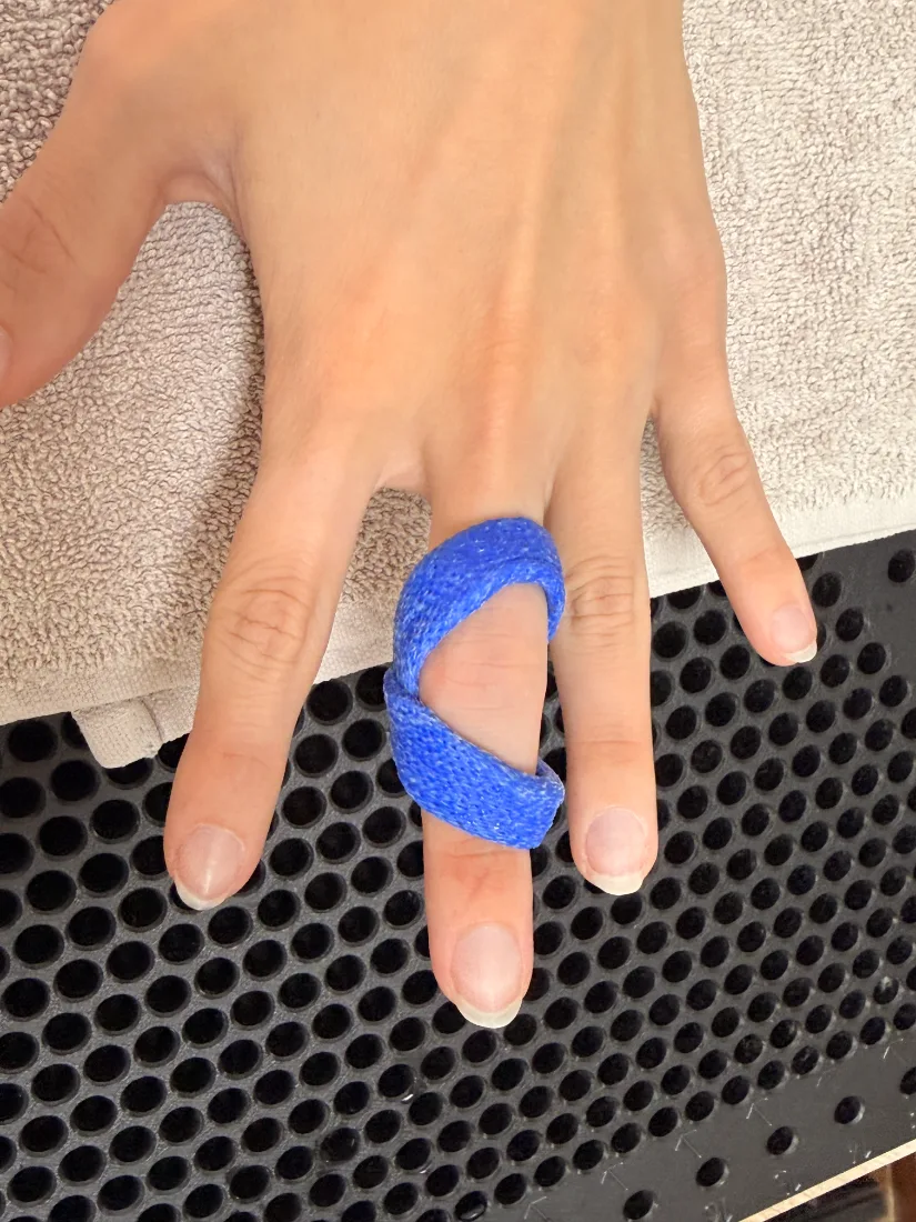 Férula de vendaje azul para dedo en RehabiliTO, Roma Sur CDMX